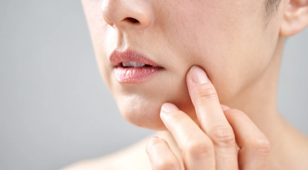 Как убрать носогубные складки?