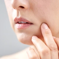 Как убрать носогубные складки?