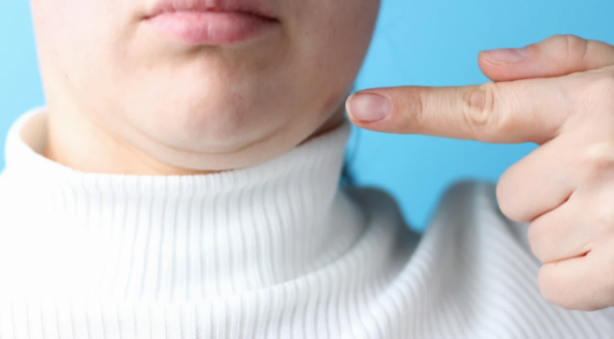 Як прибрати друге підборіддя косметологічними процедурами?