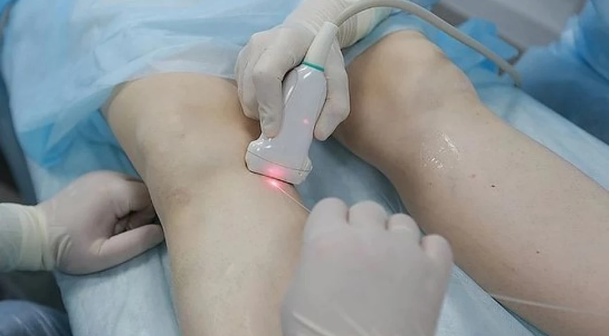 Как вылечить варикоз?