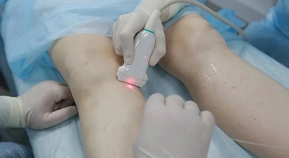 Як вилікувати варикоз?