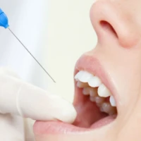 Яку анестезію використовують в стоматології?