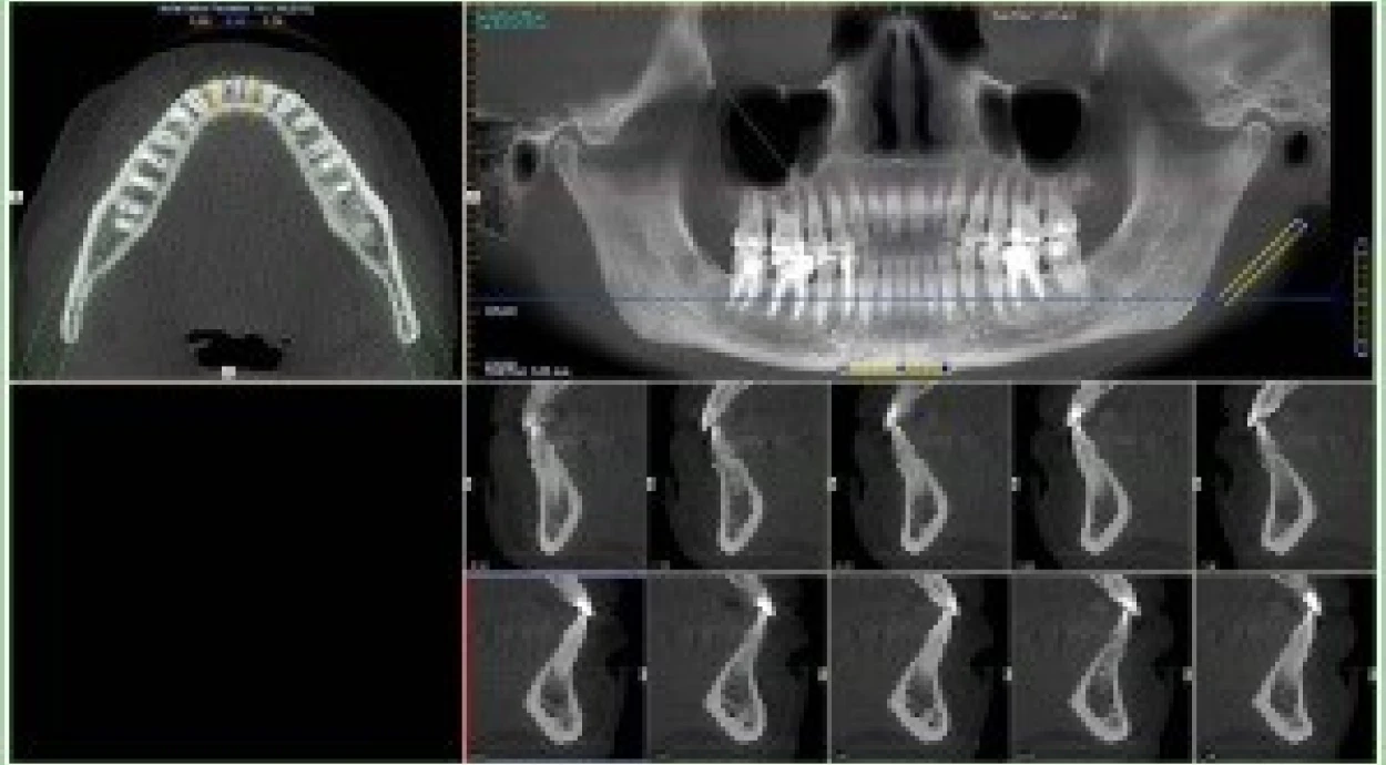 Компьютерная томография в Оксфорд Медикал Киев