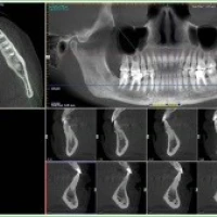 Компьютерная томография в Оксфорд Медикал Киев