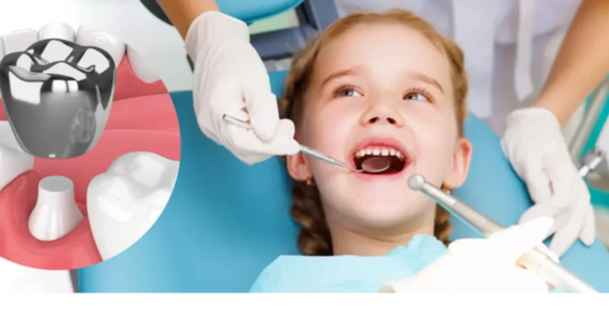 Коронки на молочные зубы: стоит ли ставить?