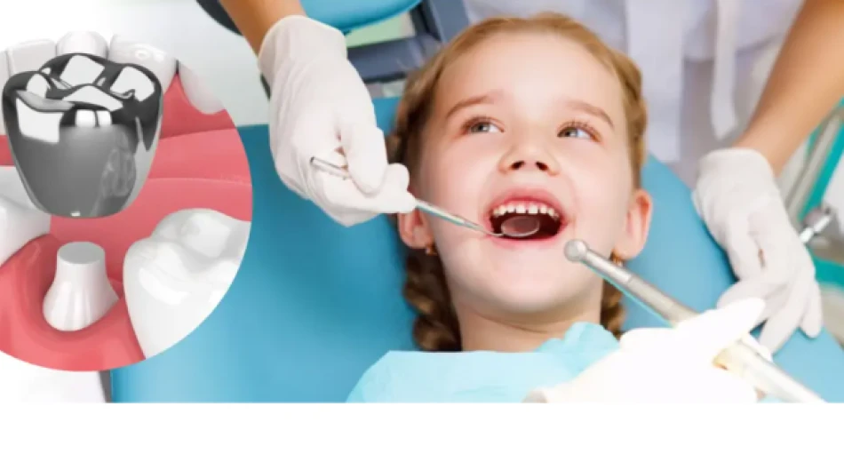 Коронки на молочные зубы: стоит ли ставить?