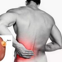 Лапароскопическое удаление кисты почки