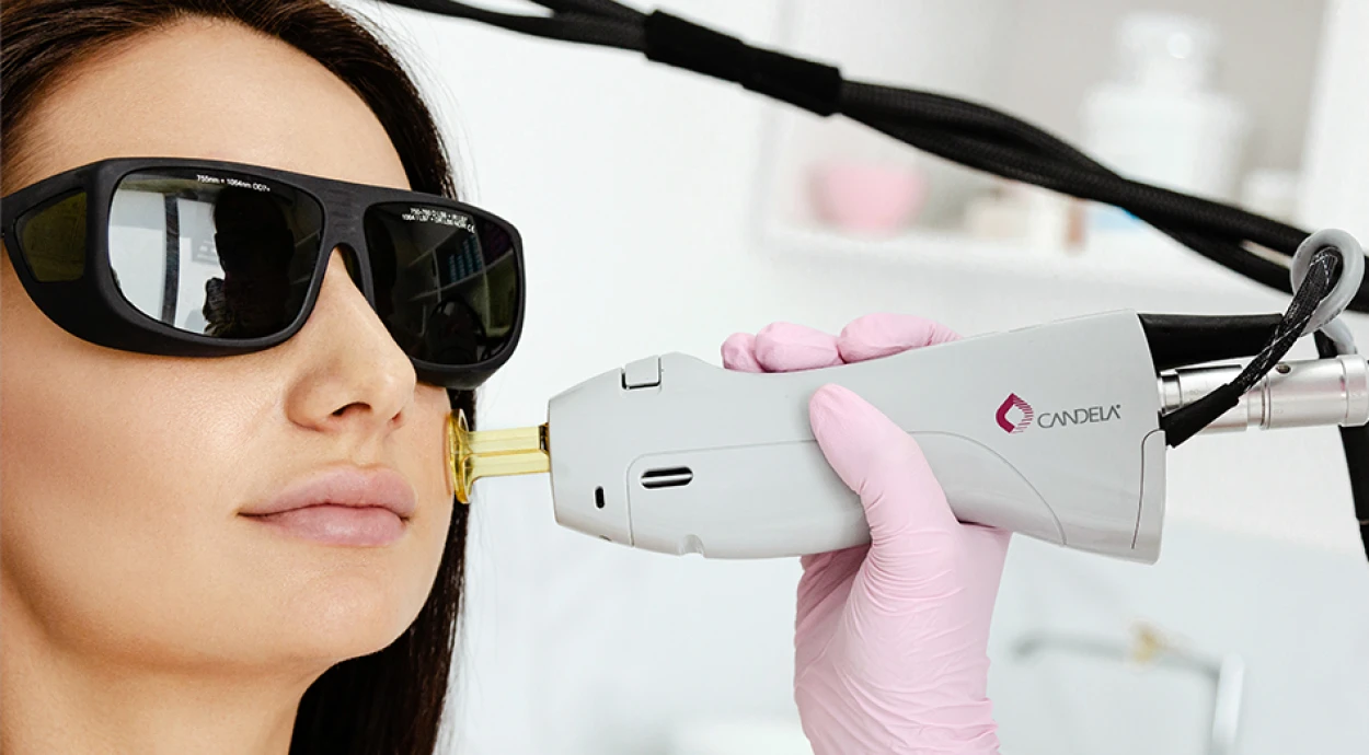 Лазерне шліфування обличчя