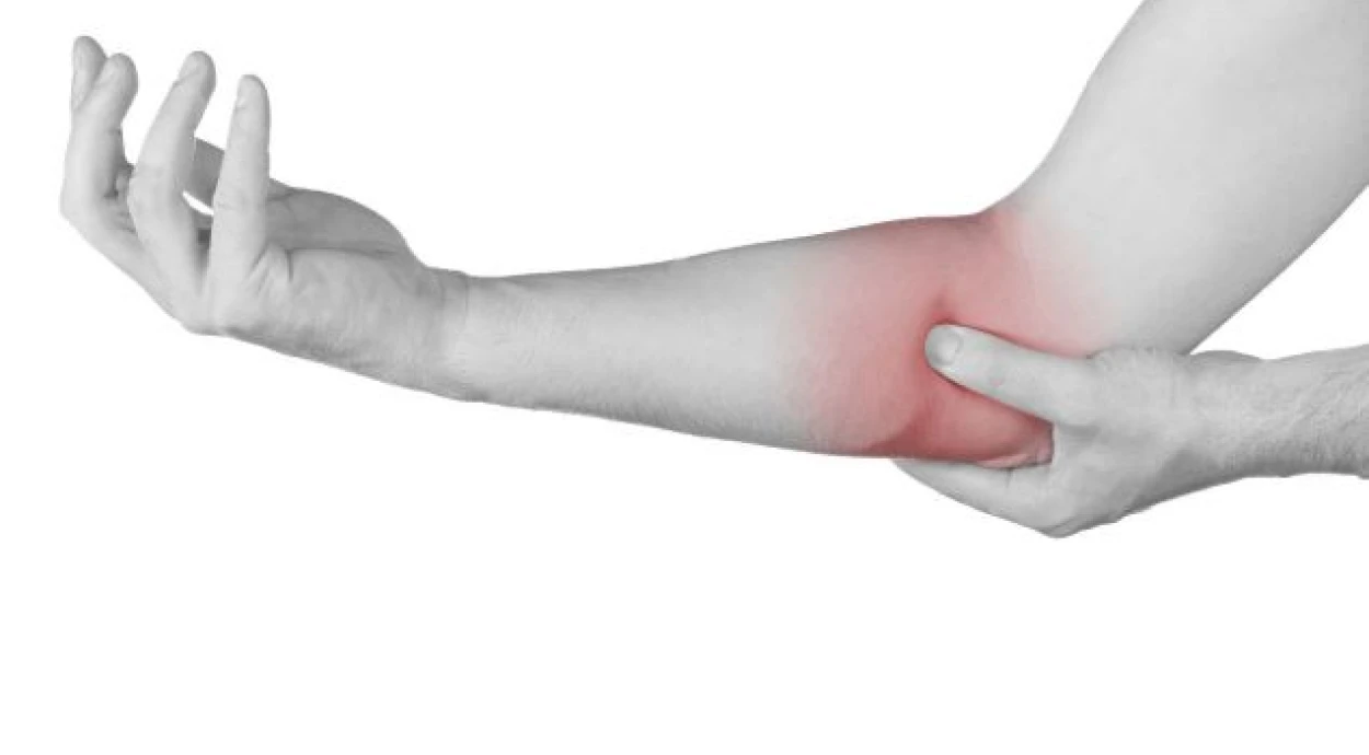 Лечение эпикондилита