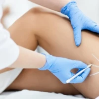 Липолиз или липомоделирование: избавляемся от жировых отложений