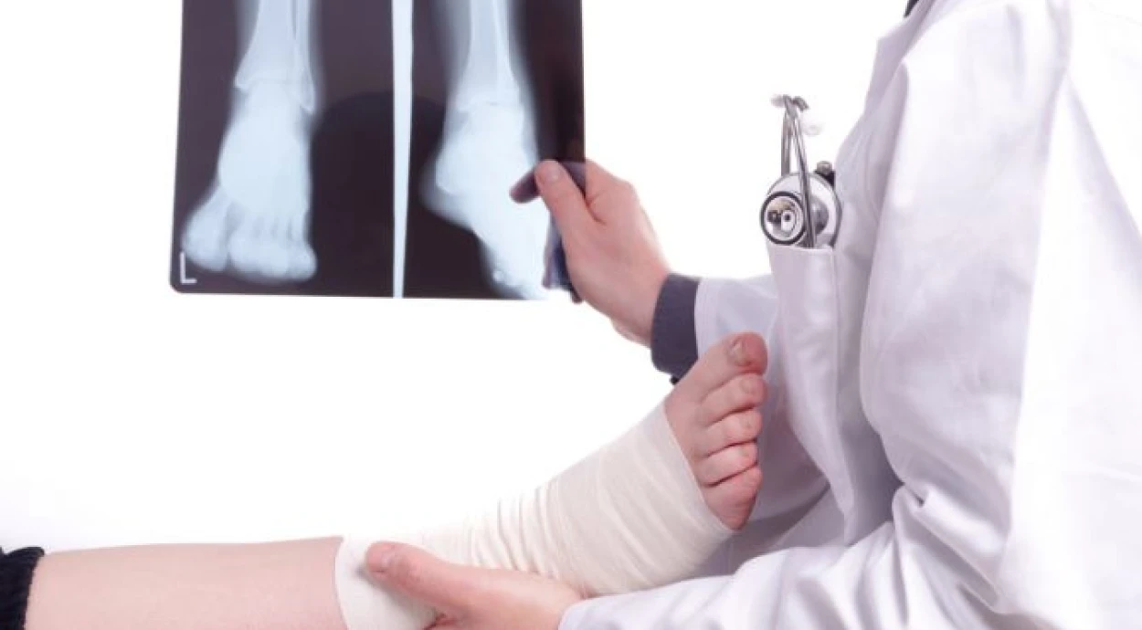 Металлоостеосинтез переломов: современные методики для быстрого восстановления