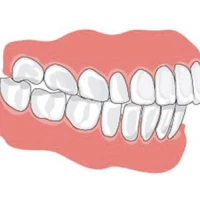 Нарушение прикуса ведет к серьезным последствиям!