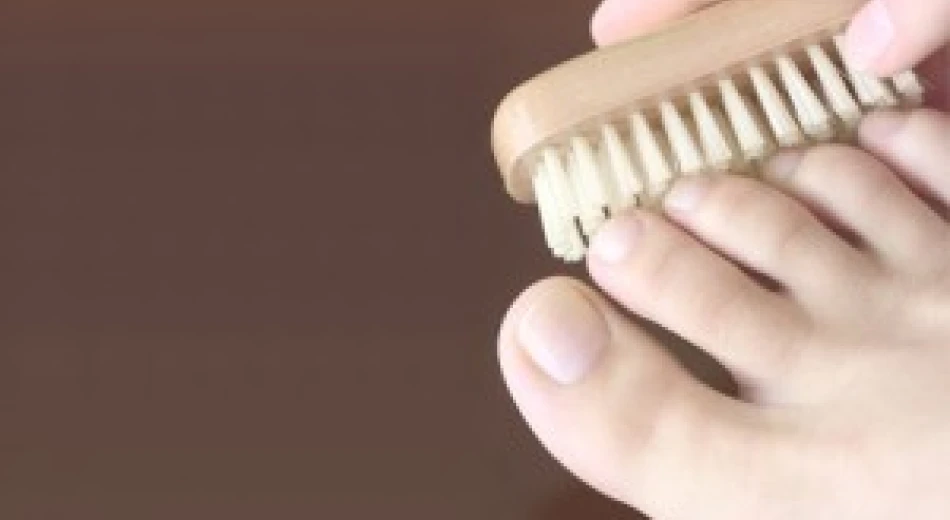 Онихомикоз: причины, симптомы, диагностика и лечение