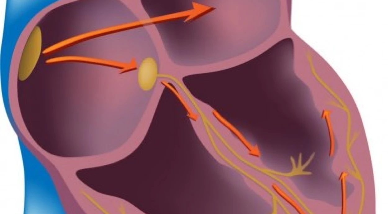 Особенности мерцательной аритмии