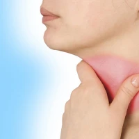 Набряк Квінке: симпоми та перша допомога