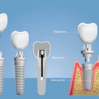 Президент Bicon посетил отделение стоматологии «Оксфорд Медикал Киев»