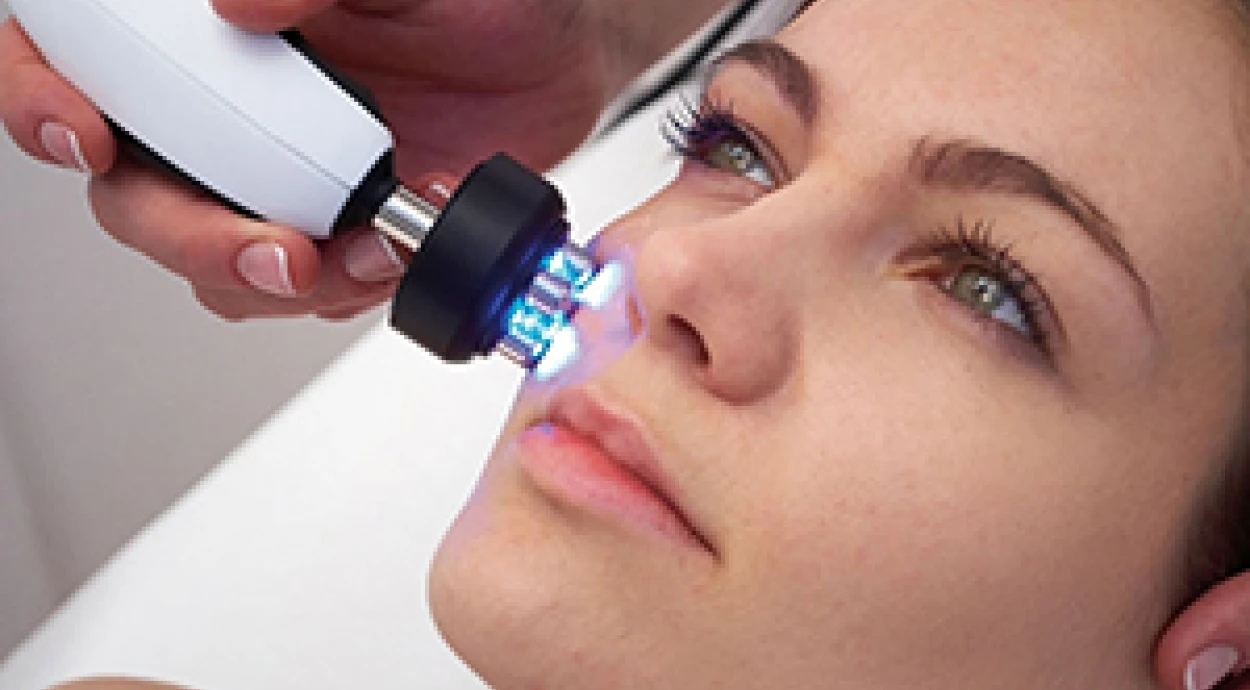 Радиолифтинг – процедура «обеденного перерыва»