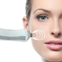 Радиоволновой лифтинг