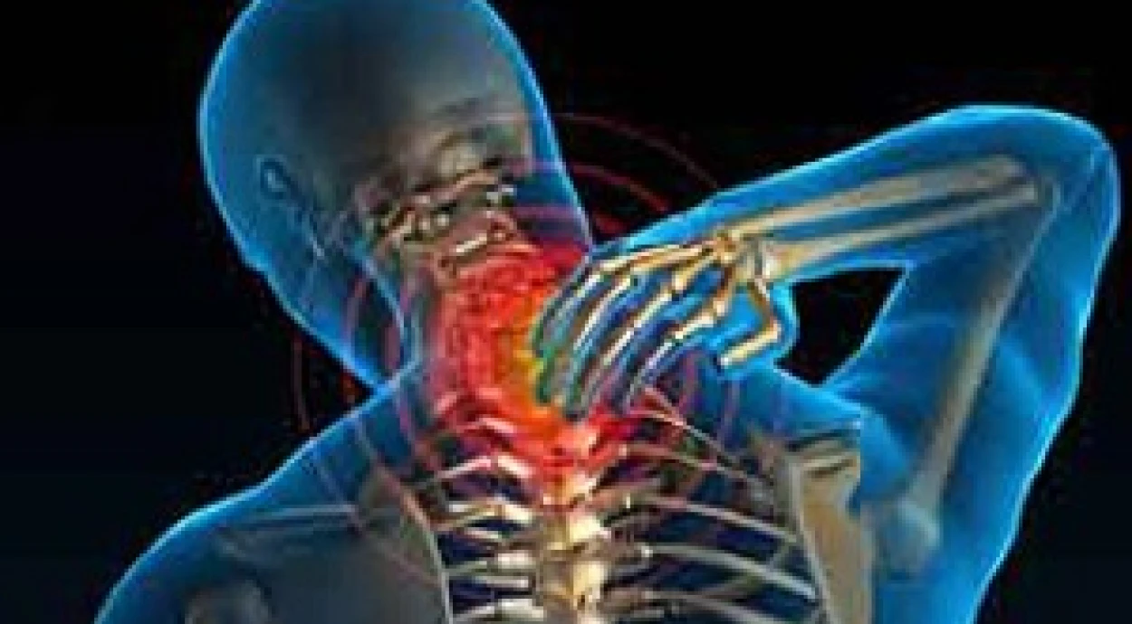 Шейный остеохондроз позвоночника