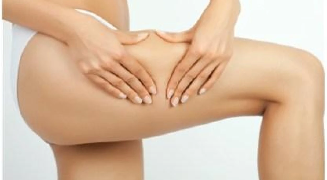 Скажем «СТОП» целлюлиту!