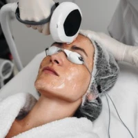 Скидка -10% на IPL-терапию