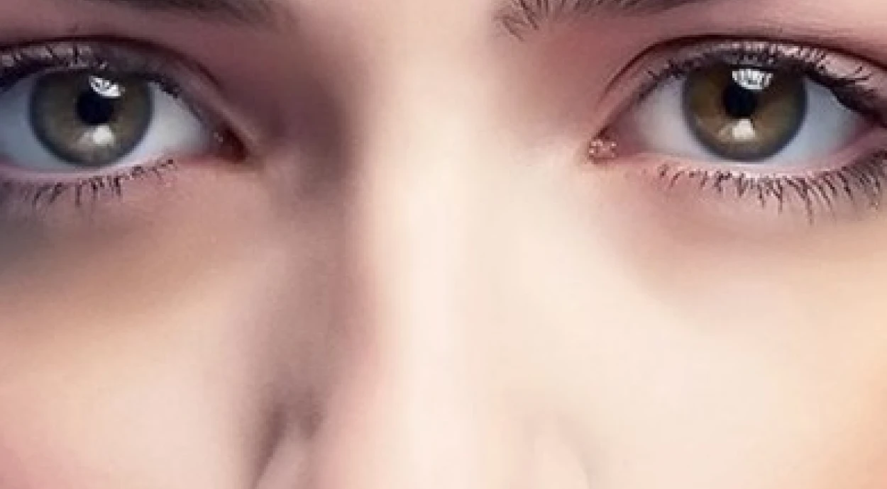 Темные круги под глазами: причины и лечение