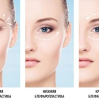 Уход за глазами после блефаропластики