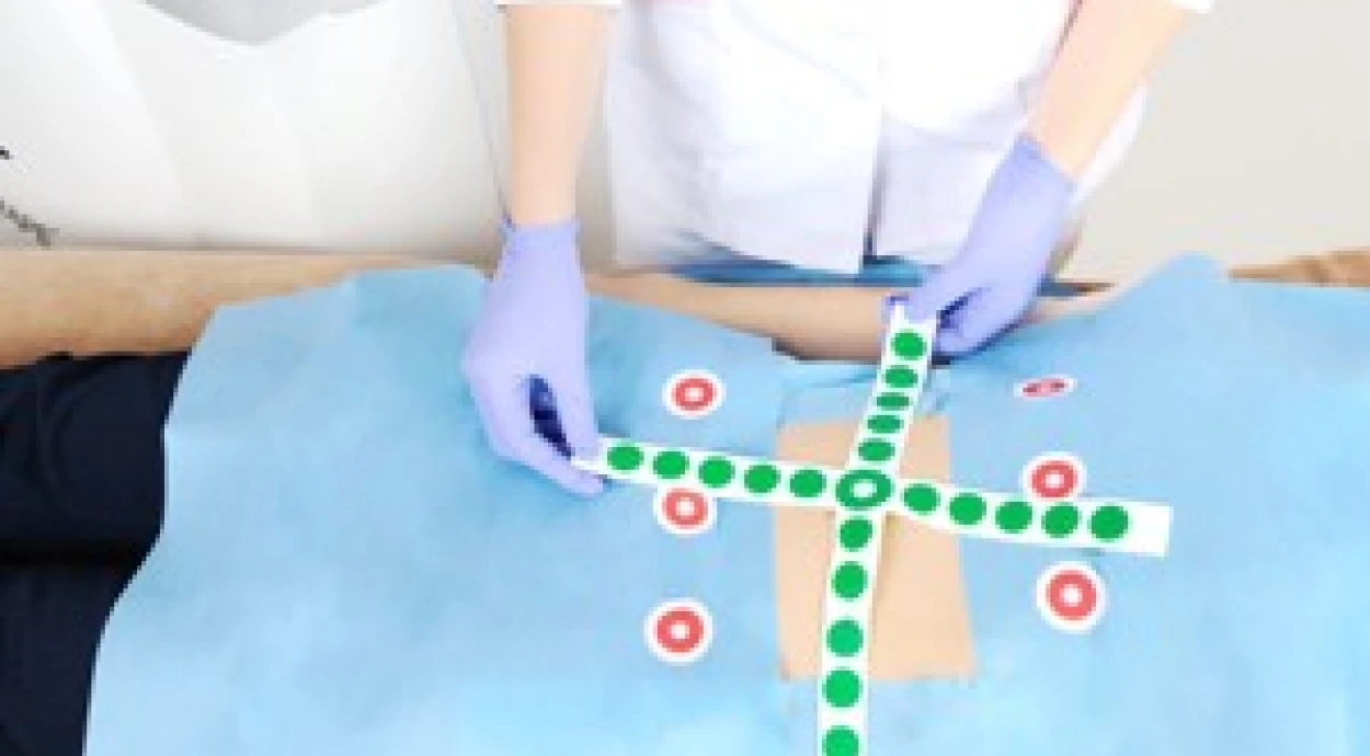 UltraShape прошла сертификацию в FDA!