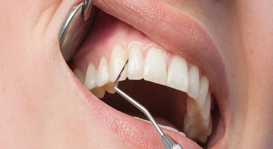 Вестибулопластика (пластика передодня порожнини рота)