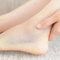 Вывихи стопы: виды, симптомы, первая помощь и лечение