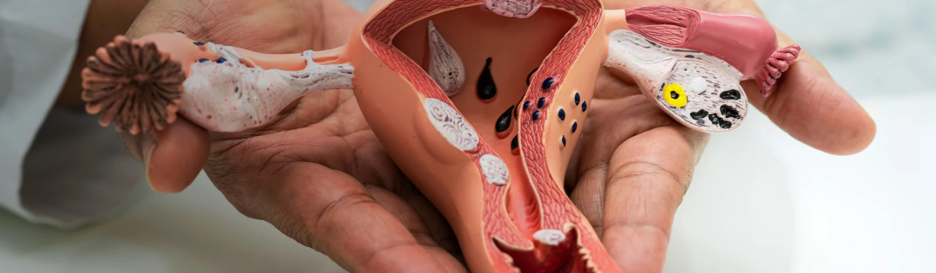 Удаление кондилом