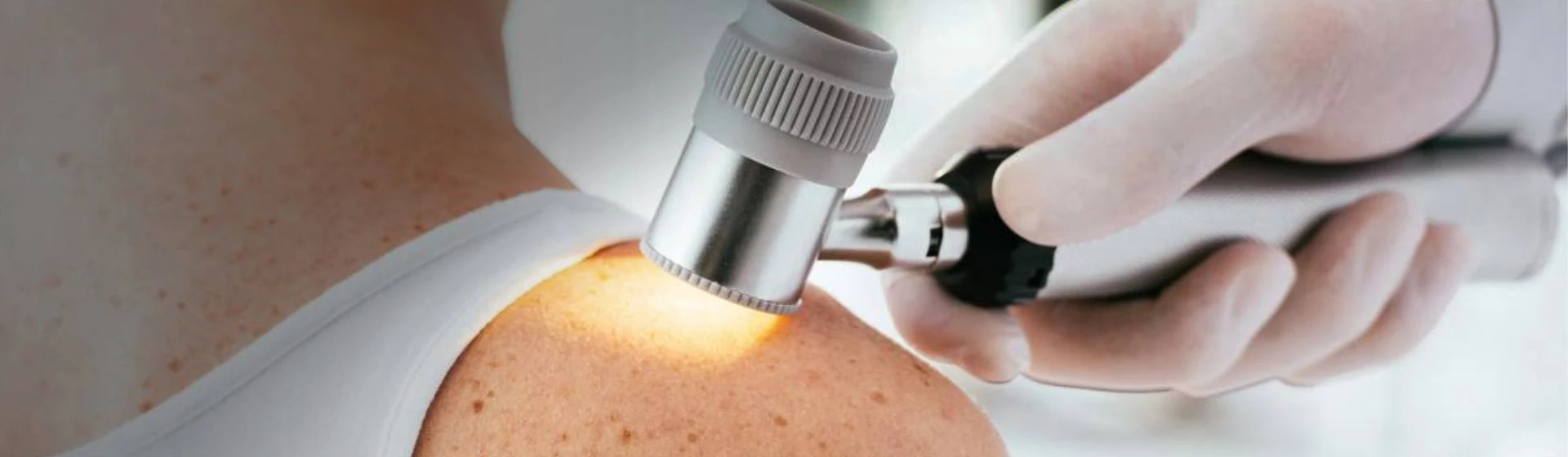 Dermatoscopy at Oxford Medical Kiev private clinic