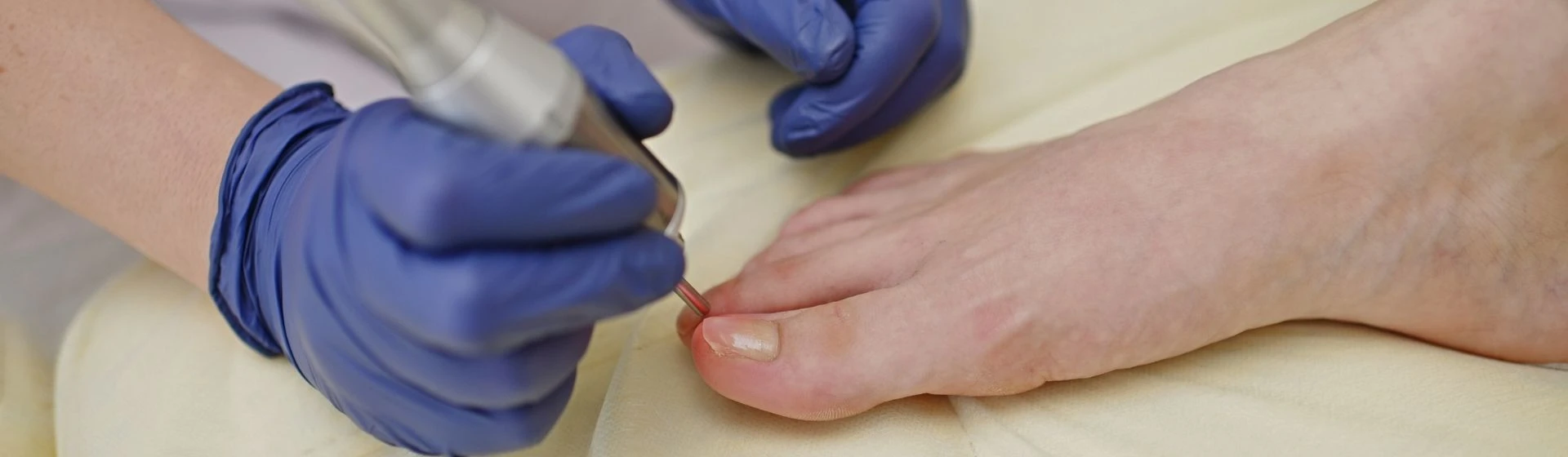 Laser treatment for nail fungus at Oxford Medical Kiev private clinic