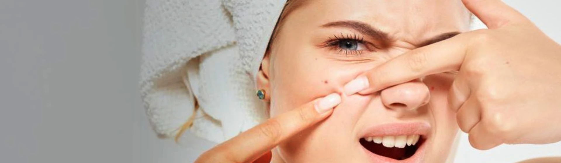 Лечение акне в частной клинике Оксфорд Медикал Киев