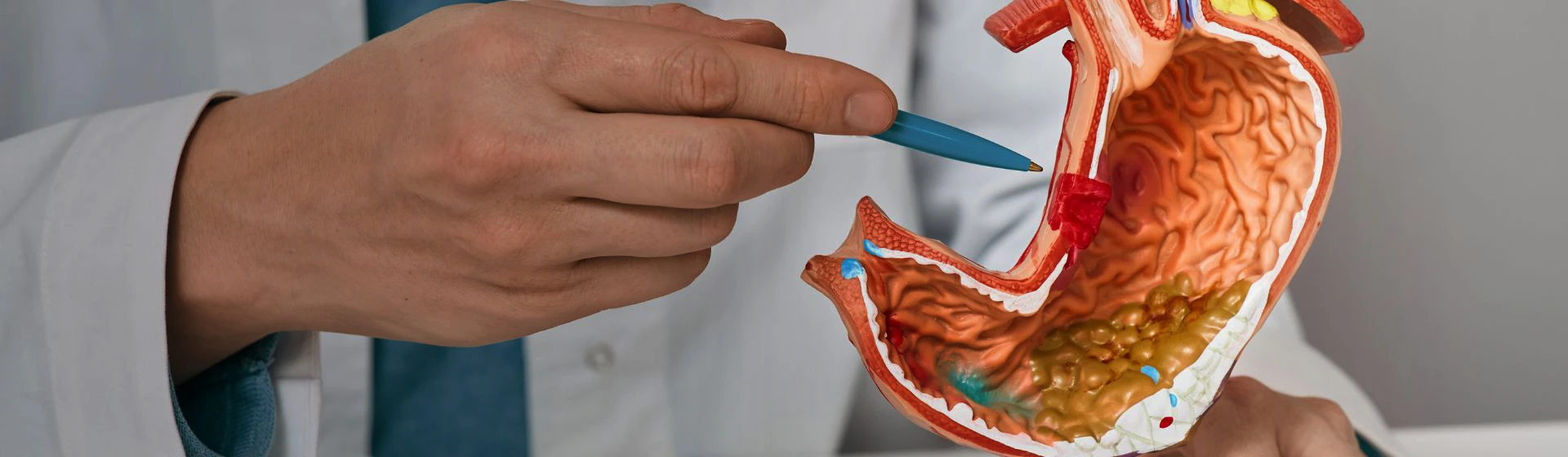 Лечение язвы желудка и двенадцатиперстной кишки в частной клинике Оксфорд Медикал Киев