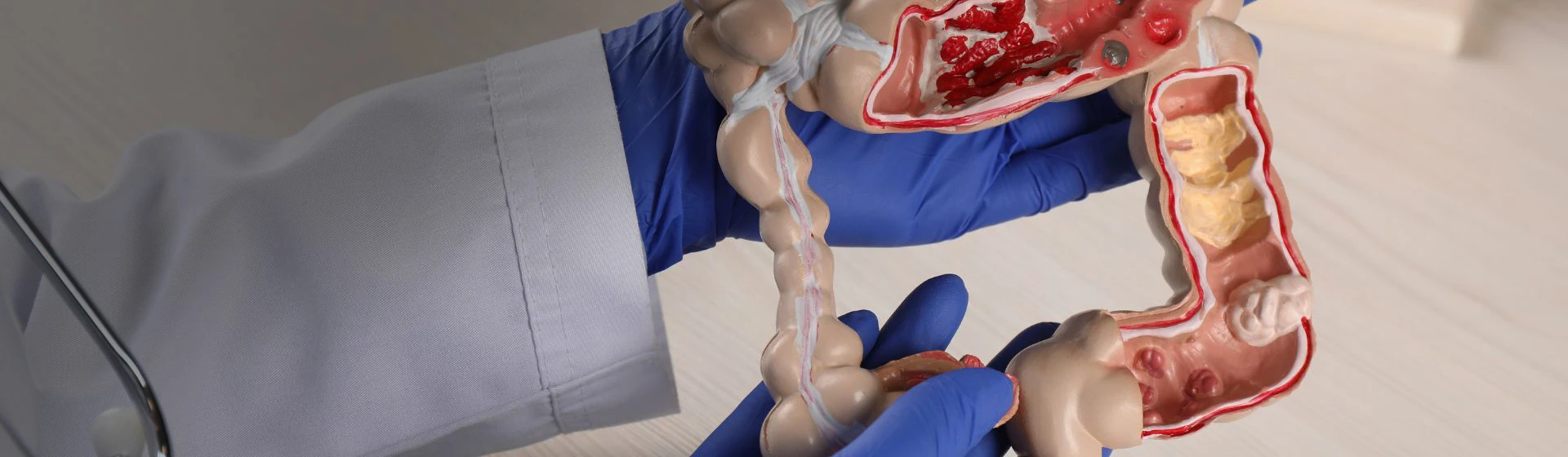 Лечение дискинезии желудка и двенадцатиперстной кишки в частной клинике Оксфорд Медикал Киев