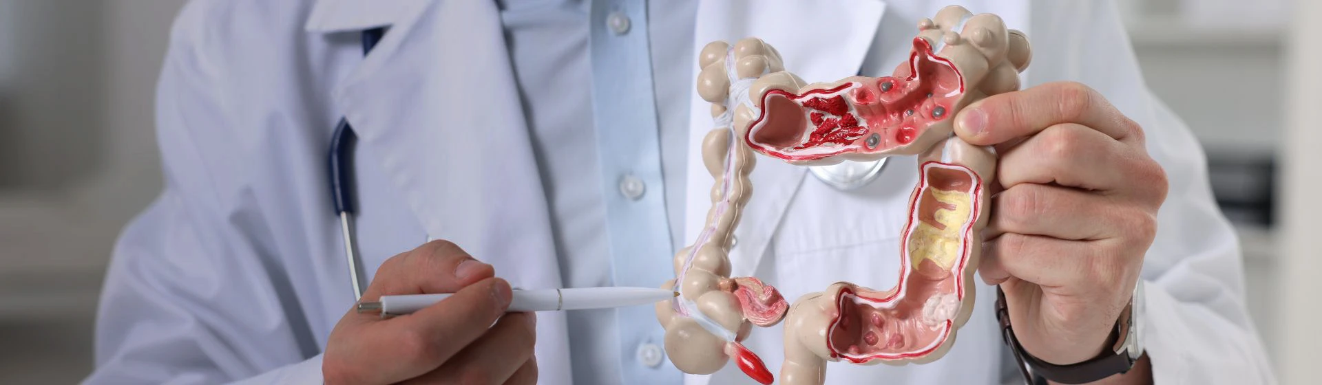 Лечение дискинезии кишечника и толстой кишки в частной клинике Оксфорд Медикал Киев