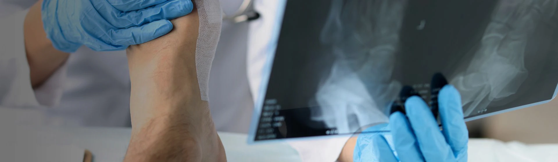 Лечение переломов в частной клинике Оксфорд Медикал Киев