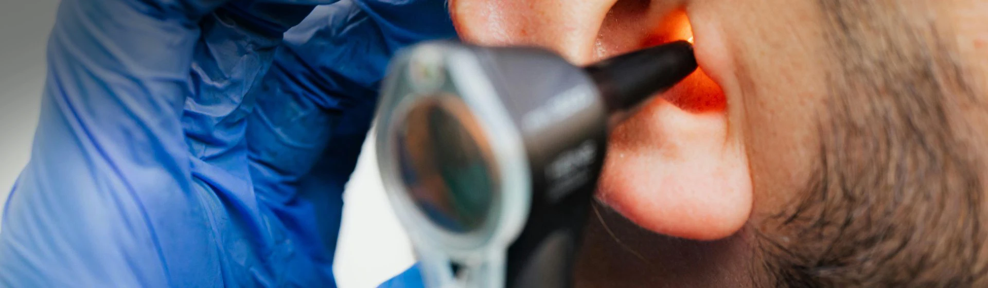 Лікування вушного дерматиту в приватній клініці Оксфорд Медікал Київ