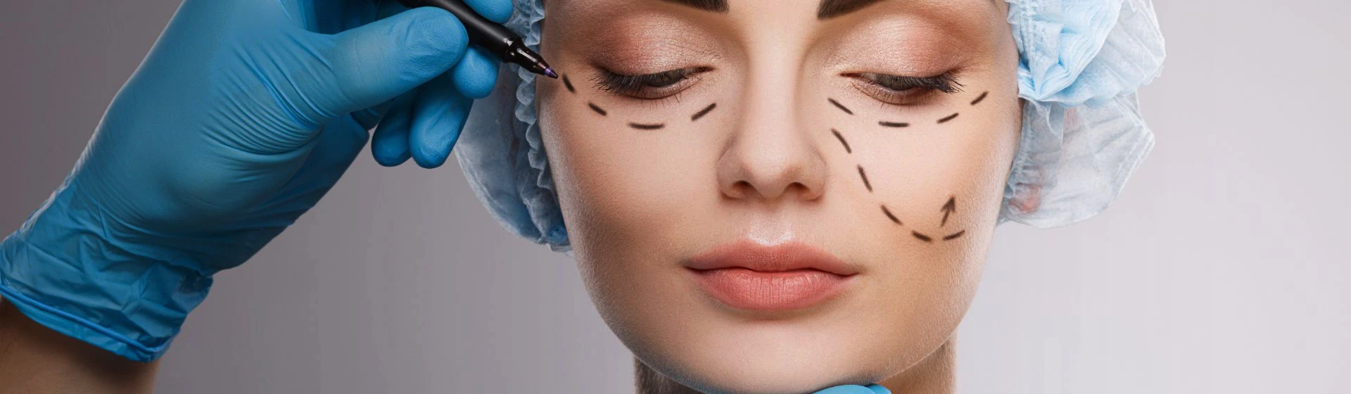 Blepharoplasty at the private clinic Oxford Medical Kyiv