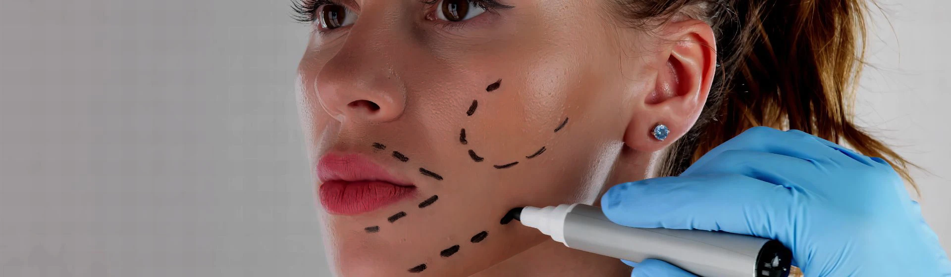 Підтяжка обличчя в приватній клініці Оксфорд Медікал Київ