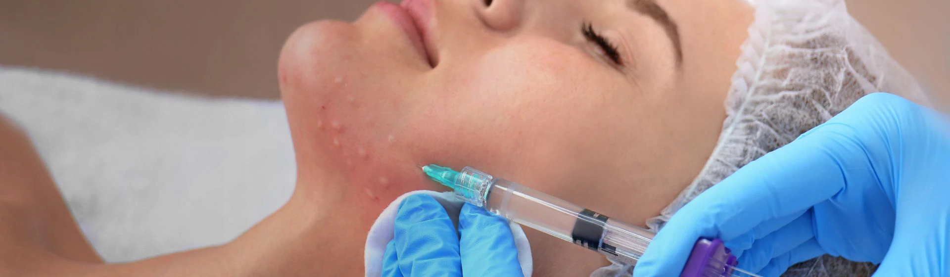 Mesotherapy at the private clinic Oxford Medical Kyiv