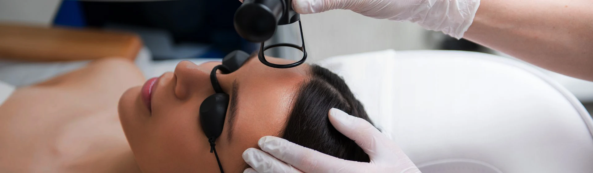 Лазерное удаление пигментных пятен в частной клинике Оксфорд Медикал Киев