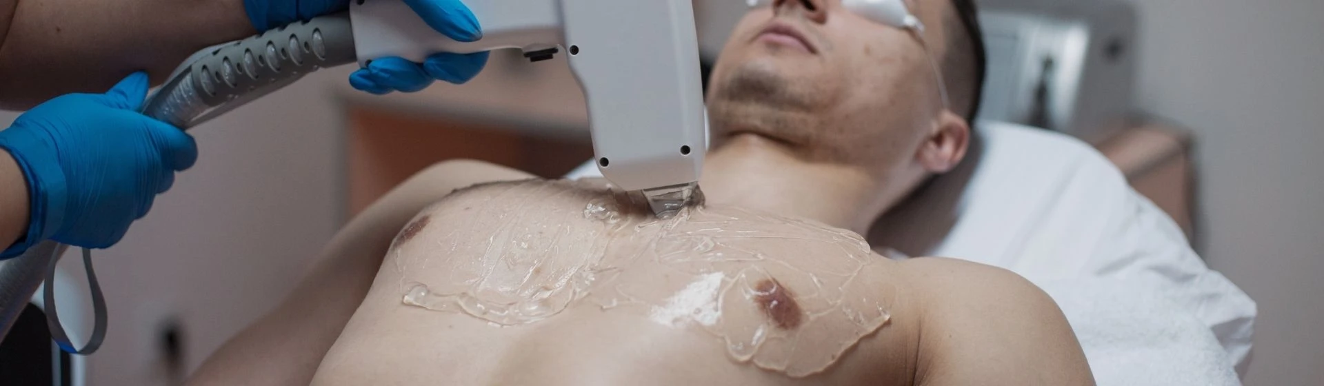 Лазерная эпиляция волос на груди у мужчин в частной клинике Оксфорд Медикал Киев