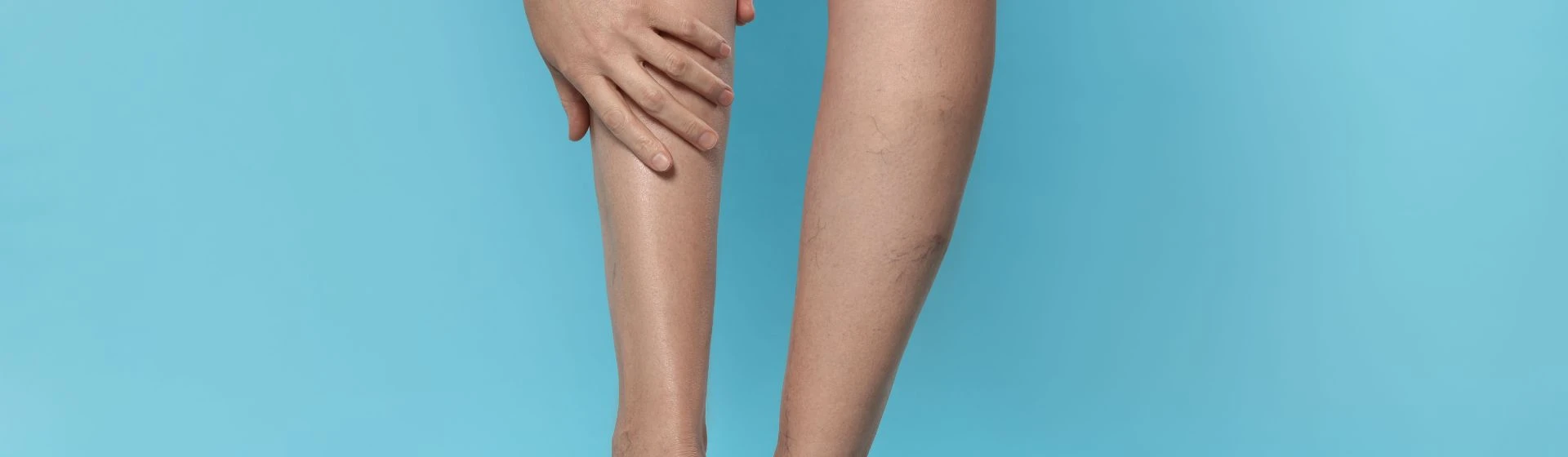 Лазерне лікування варикозу в приватній клініці Оксфорд Медікал Київ