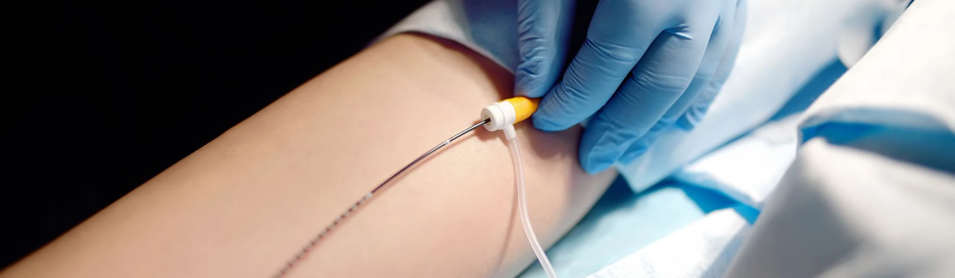 Шунтирование сосудов нижних конечностей в частной клинике Оксфорд Медикал Киев