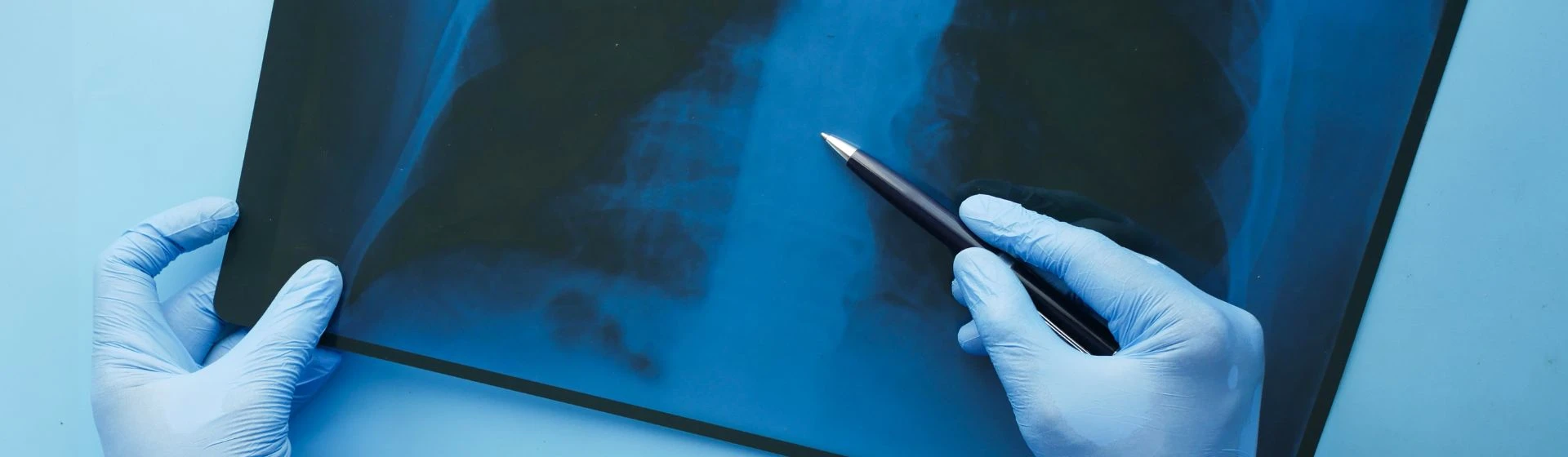 Рентген позвоночника в частной клинике Оксфорд Медикал Киев