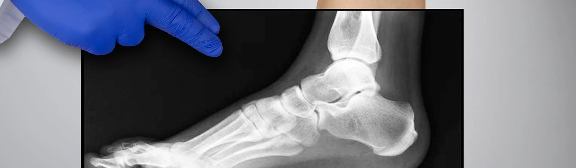 Рентген суставов в частной клинике Оксфорд Медикал Киев