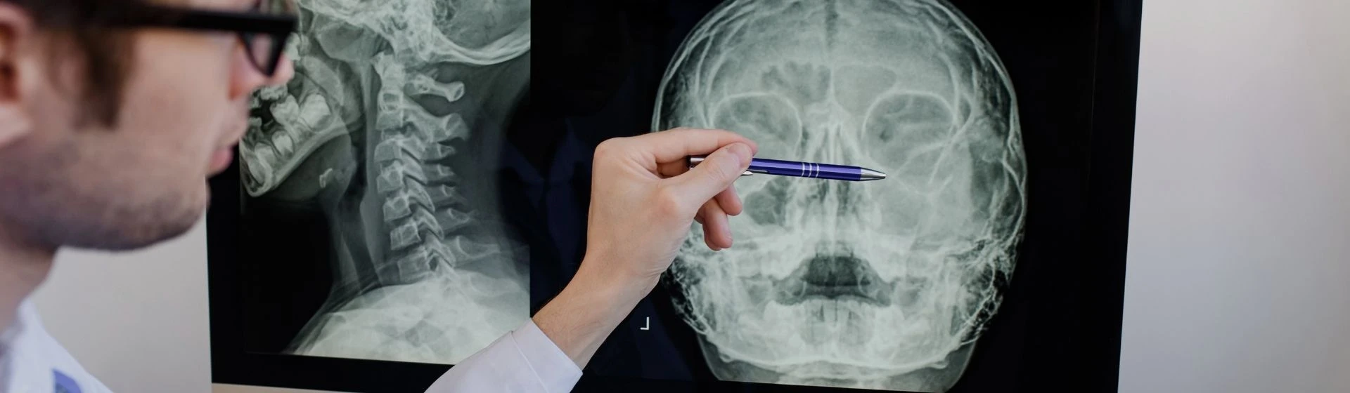 Рентген пазух носа в приватній клініці Оксфорд Медікал Київ