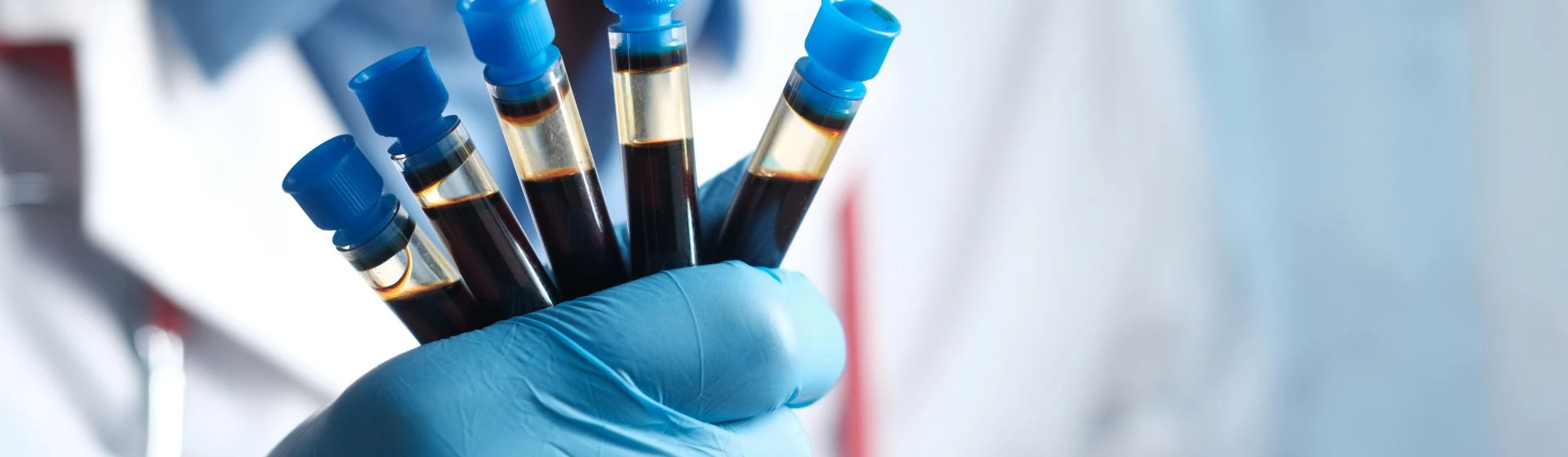 Анализы на Позняках в клинике Оксфорд Медикал